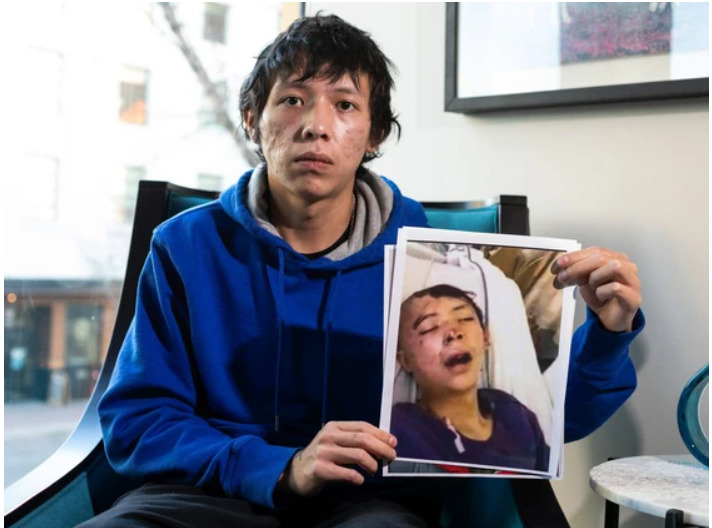 A seated indigenous man in a blue sweatshirt holding up a photograph of himself, unconscious and bruised in hospital.
